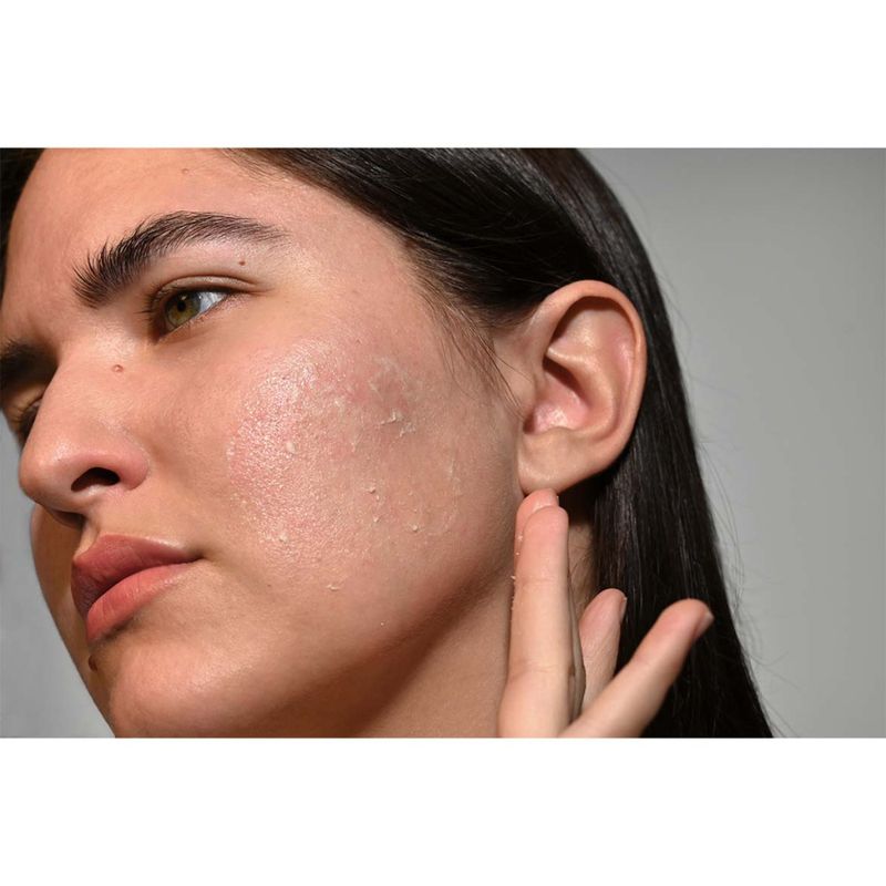 Triple Effect Peeling 50 ml - Dr. Schrammek